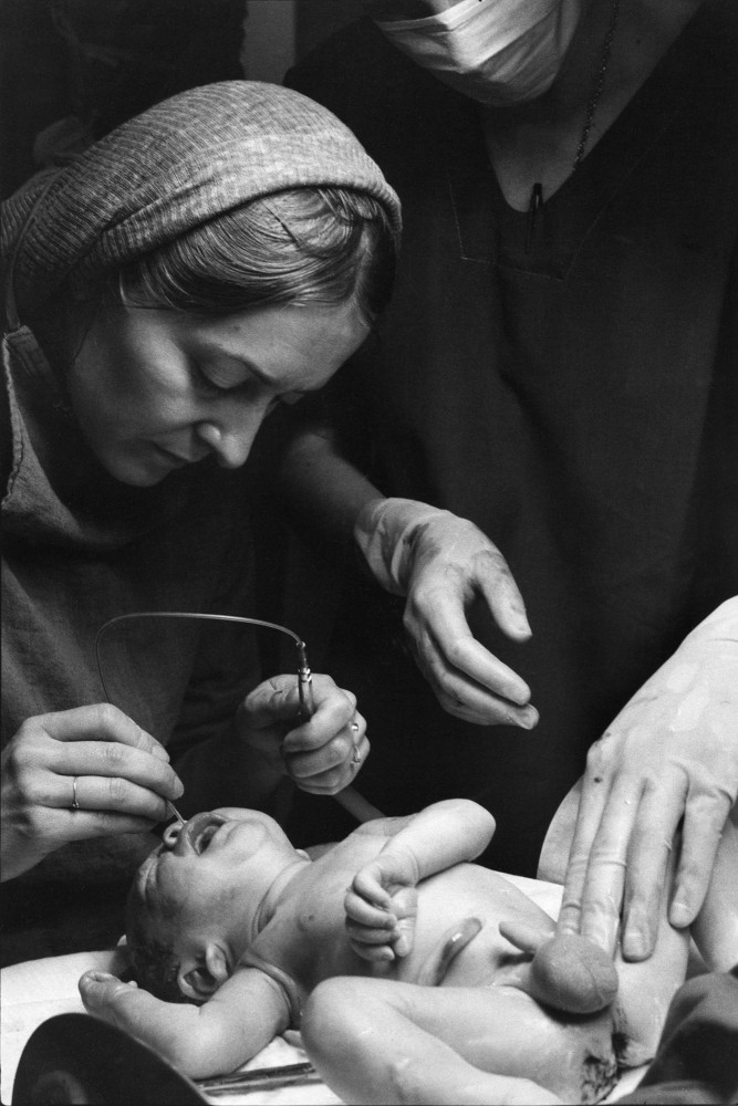 Soins nouveau-né (aspiration), après naissance, Maternité de l'hôpital Jean Rostand, Sèvres (Hauts de Seine), 1982